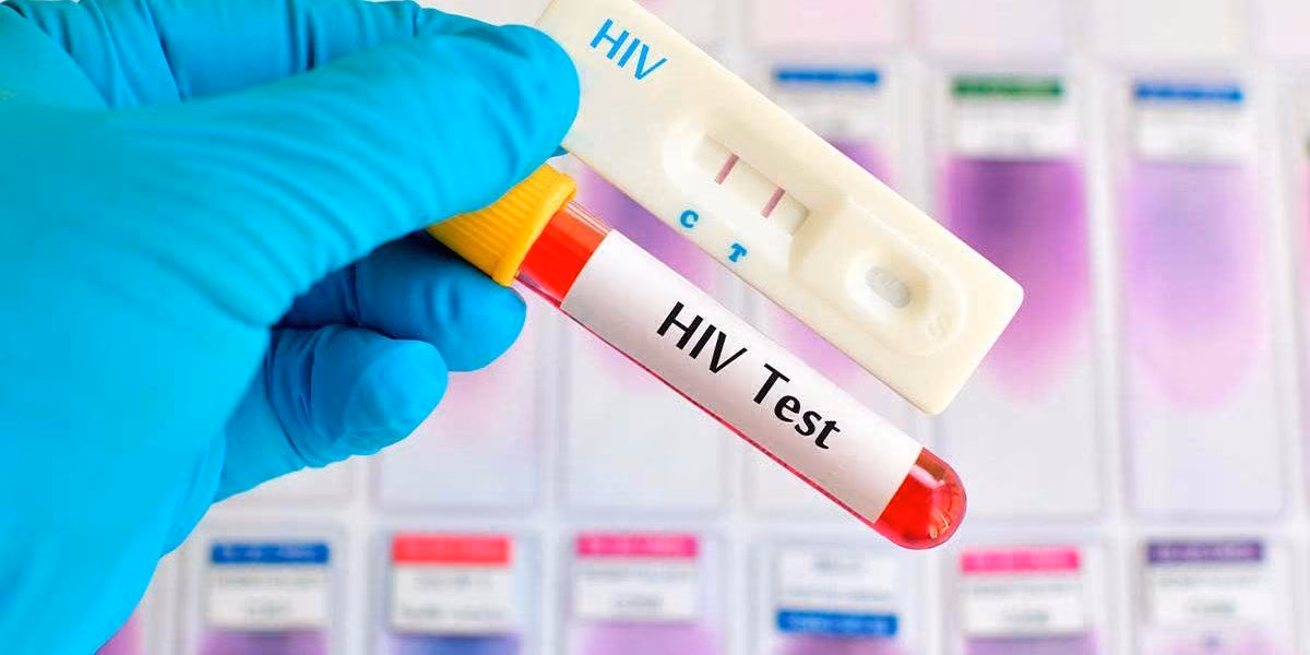 Ilustrasi periode jendela tes HIV